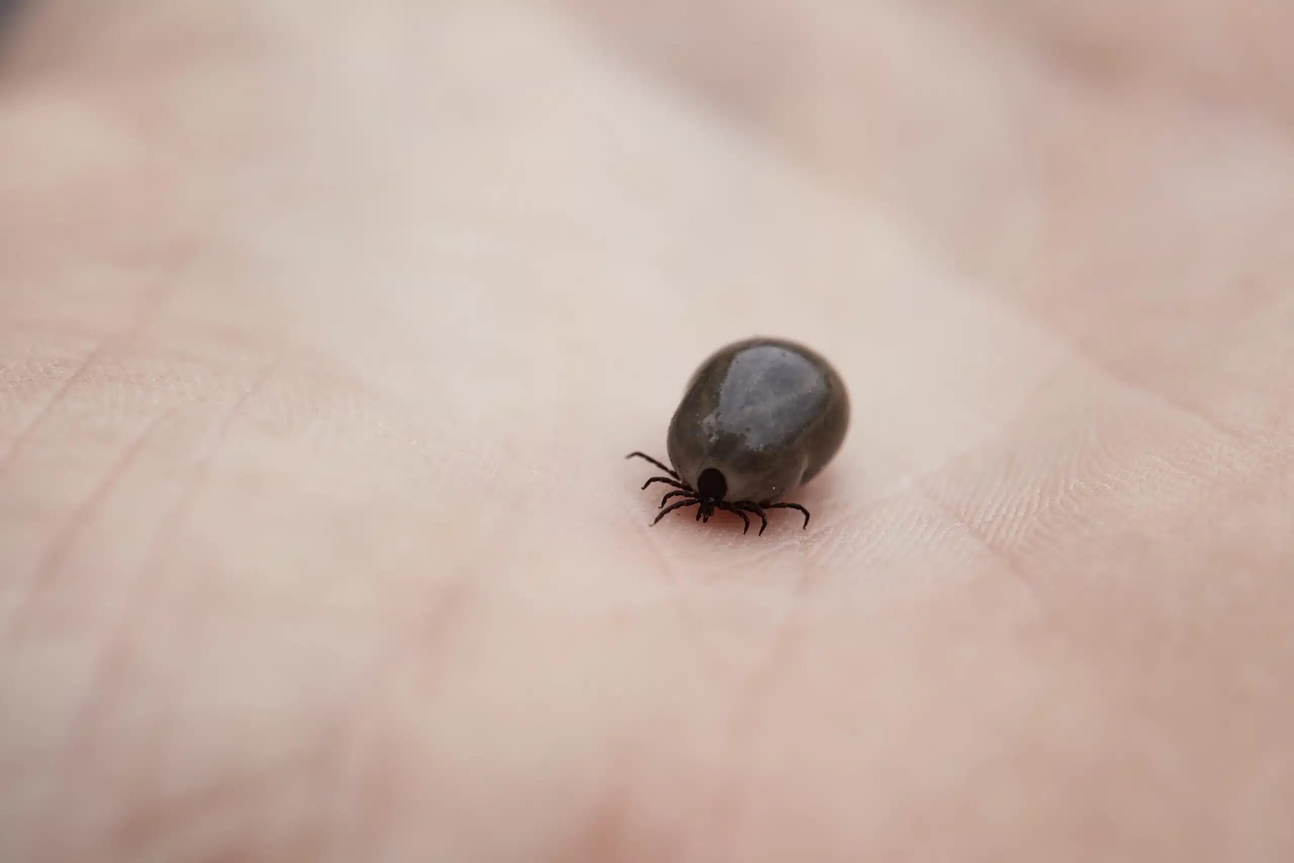 Tick on human hand